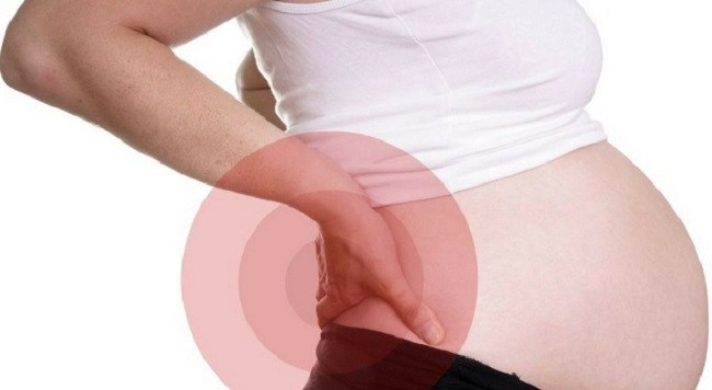 Đau lưng bên phải gần eo khi mang thai
