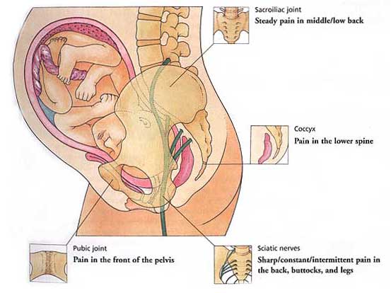 Đau xương chậu ở phụ nữ mang thai 3 tháng đầu