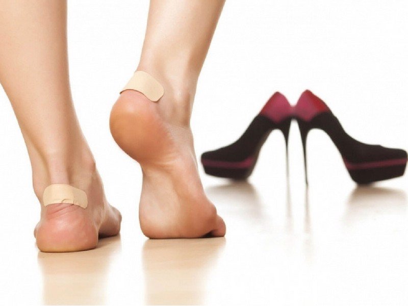 Đi giày bị đau gót chân phải làm sao?