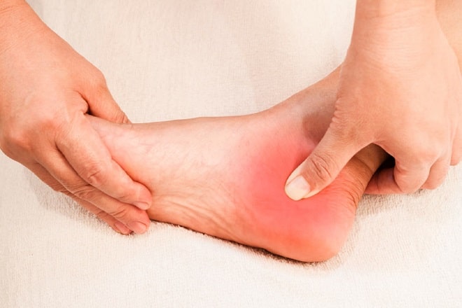 Điều trị đau gót chân tại nhà