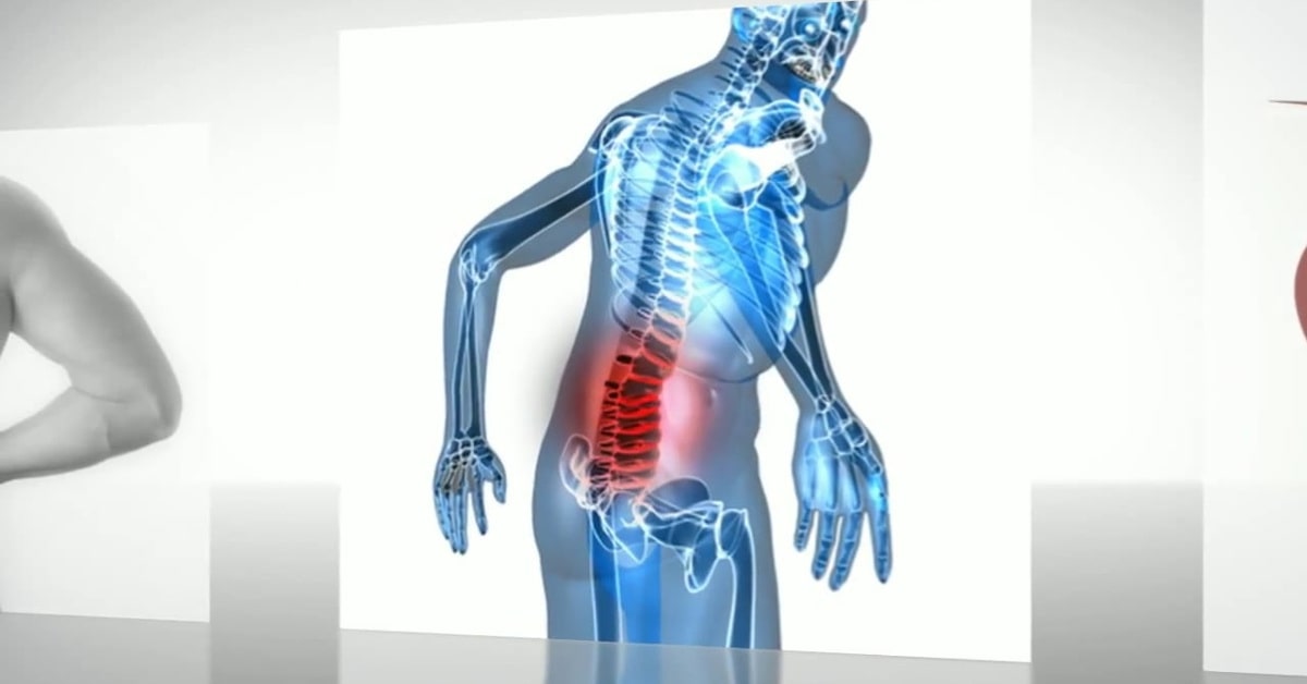 Triệu chứng đau cột sống vùng thắt lưng
