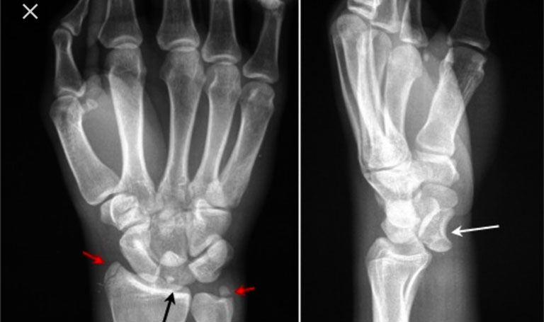 Hasuta Việt Nam Chuyên cung cấp thiết bị chăm sóc sức khỏe tốt nhất việt nam