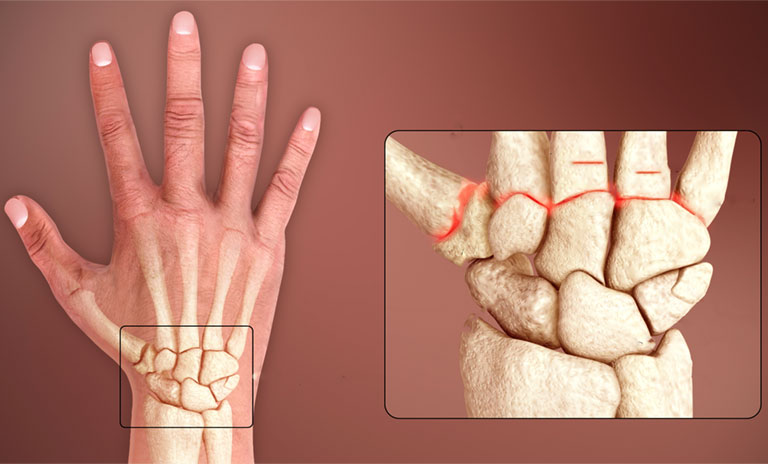 Hasuta Việt Nam Chuyên cung cấp thiết bị chăm sóc sức khỏe tốt nhất việt nam