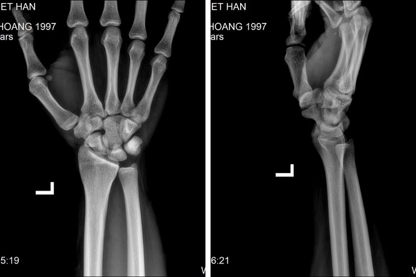 Hasuta Việt Nam Chuyên cung cấp thiết bị chăm sóc sức khỏe tốt nhất việt nam