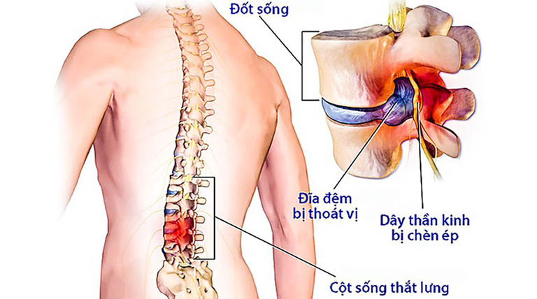 Hasuta Việt Nam Chuyên cung cấp thiết bị chăm sóc sức khỏe tốt nhất việt nam