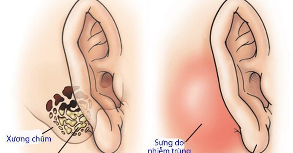Hasuta Việt Nam Chuyên cung cấp thiết bị chăm sóc sức khỏe tốt nhất việt nam